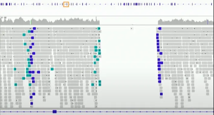 Inversão de éxon no gene DMD